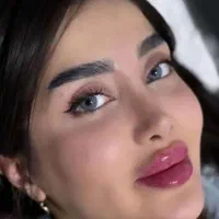جشنواره تزریق ژل و بوتاکس در مطب با۴۰درصد تخفیف|خدمات آرایشگری و زیبایی|کرمانشاه, |دیوار