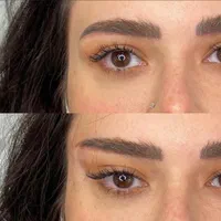 ژل لب بوتاکس فیلر انزیم کامپوزیت دندان|خدمات آرایشگری و زیبایی|مشهد, راهنمایی|دیوار