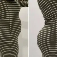 لیپوماتیک وساکشن وابدو