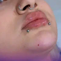 ژل لب،بوتاکس،زاویه سازی توسط پزشک|خدمات آرایشگری و زیبایی|تهران, صادقیه|دیوار