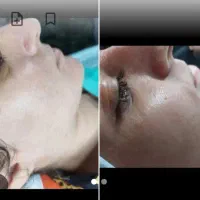 تخفیف پکیج اختصاصی پاکسازی پوست فقط ۳۰۰|خدمات آرایشگری و زیبایی|اراک, |دیوار
