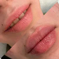 آخرین تخفیف تابستانه کیلینیک نوین|خدمات آرایشگری و زیبایی|رشت, گلسار|دیوار