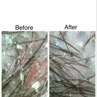 آموزش تخصصی اسکراب اسکالپ مو با ۵۰ درصد تخفیف|خدمات آموزشی|ارومیه, |دیوار