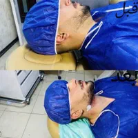 ساکشن غبغب با پال دیجیتالی و اندولیفت پوست اضافه|خدمات آرایشگری و زیبایی|مشهد, سناباد|دیوار