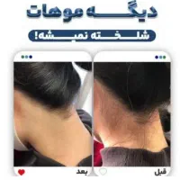 آموزش لیزر موج کندلا مرکز لیزر آقایان لیزر بانوان|خدمات آموزشی|اصفهان, شمس آباد|دیوار