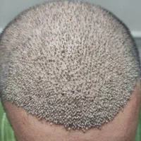 کاشتمو|خدمات آرایشگری و زیبایی|نیشابور, دارایی|دیوار