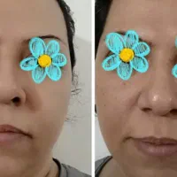 روتین پوستی مهلران|خدمات آموزشی|احمدآبادمستوفی, |دیوار