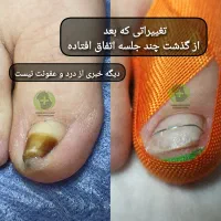 درمان بیماری های ناخن بدون جراحی درکلینیک|خدمات آرایشگری و زیبایی|ورامین, خیر آباد|دیوار