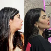 کانتورینگ و زیبایی چهره با نصف قیمت اصلی