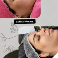 فیشیال و پاکسازی پوست|خدمات آرایشگری و زیبایی|اهواز, رسالت|دیوار