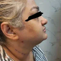 ژل و چربی|خدمات آرایشگری و زیبایی|ایلام, |دیوار