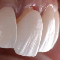 دندانپزشکی اقساطی با تعرفه مناسب|خدمات آرایشگری و زیبایی|هشتگرد, شهرک ولیعصر (مصلی)|دیوار