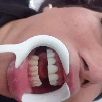 مژده مژده کامپوزیت برای یک ماه  تخفیف ویژه|خدمات آرایشگری و زیبایی|یاسوج, |دیوار