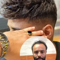 ترمیم و پروتز