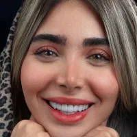 کامپوزیت دندان لمینت ایمکس جشنواره ویژه