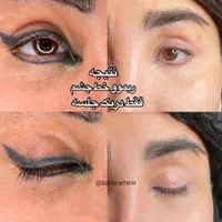 ریموو  هر نوع تتویی  کاملا تضمینی اف خورده