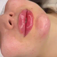 مرکز تخصصی تزریق بوتاکس فیلرگونه چشم زاویه آنزیم|خدمات آرایشگری و زیبایی|اندیشه, اندیشه فاز ۱|دیوار