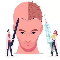 استخدام دستیار کاشت مو