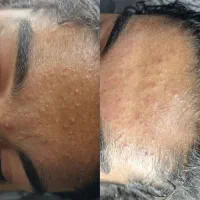 انجام خدمات و آموزش حرفه ای پوست و فیشال و پاکسازی