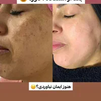 محصولات آرایشی و بهداشتی و درمانی وکرم های ضدلک|آرایشی، بهداشتی، درمانی|شیراز, گویم|دیوار