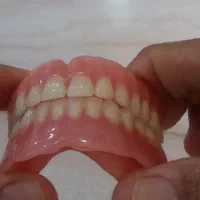 ساخت دندان مصنوعی متحرک