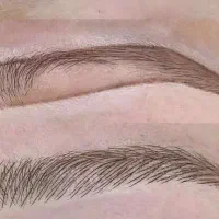 مدل برای اجرای میکروبلیدینگ به سبک فیبروز