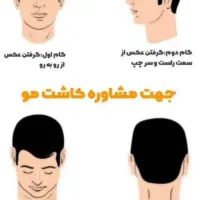 جشنواره کاشت مو