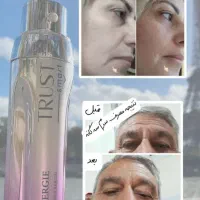 مشاورتخصصی پوست ومو|خدمات آرایشگری و زیبایی|شیراز, دارالرحمه|دیوار