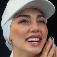 دندان کامپوزیت دندانپزشکی|خدمات آرایشگری و زیبایی|مشهد, دانشجو|دیوار