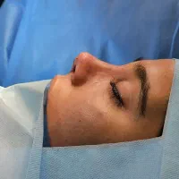 تبدیل دماغ به بینی فقط ۴۰ تومن