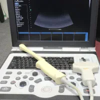 واردات فروش و تعمیرات دستگاه های سونوگرافی