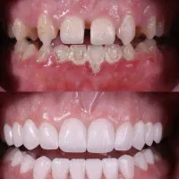 دندانپزشکی اقساط با بهترین دندانپزشک کرمان