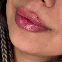 ژل لب شب یلدا