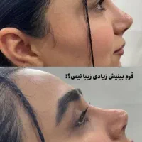عمل پلک/اندسکپیک/بینی/غبغب