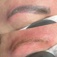 پاک کردن انواع تتو و بلفاروپلاستی در جنوب تهران|خدمات آرایشگری و زیبایی|باقرشهر, |دیوار