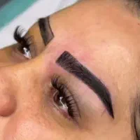 کاشت ابرو و مژه