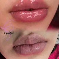 ژل و بوتاکس مزو و انزیم، سیار هستم...|خدمات آرایشگری و زیبایی|قرچک, شهرک طلائیه|دیوار