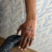 اموزش و اجرای تتو ،پاک کردن تتو با لیزر