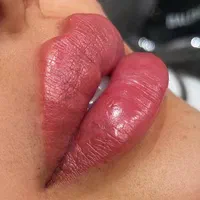 بلفاروپلاستی و رفع پف چشم ، لیفت شقیقه .جراح متخصص|خدمات آرایشگری و زیبایی|اردبیل, |دیوار