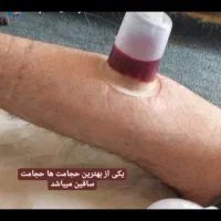 حجامت بهداشتی و حرفه ای و بهداشتی سیار