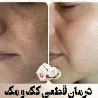 کرم ژل رویال روشن کننده پوست|آرایشی، بهداشتی، درمانی|تربت‌حیدریه, آغوی|دیوار