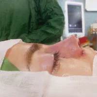 عمل بینی،کامپوزیت دندان،کاشت مو