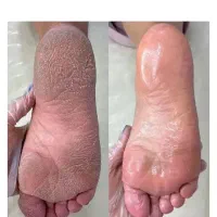 مدل برای پدیکور تضمینی