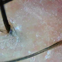 پاکسازی کف سر تخصصی / کراتین و پروتئین|خدمات آرایشگری و زیبایی|اصفهان, کوی ولی عصر|دیوار