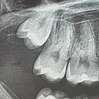 منشی دندانپزشکی