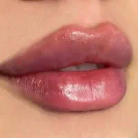 تزریق ژل و بوتاکس توسط پزشک|خدمات آرایشگری و زیبایی|تهران, صادقیه|دیوار