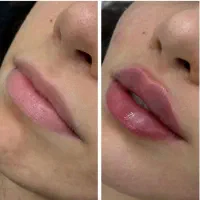 خدمات تخصصی زیبایی ، ژل ، بوتاکس در مطب دکتر شریفی