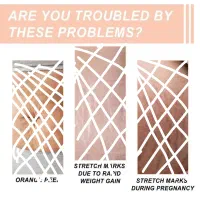 کرم ضد ترک شکم