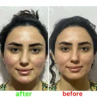 کلنیک زیبایی پوست و موی ارامش