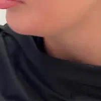 مدل برای فیلر و بوتاکس فقط هزینه موادگرفته میشود|خدمات زیبایی و سلامت|کرج, گلشهر|دیوار
